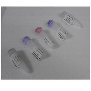 AMV Reverse Transcriptase