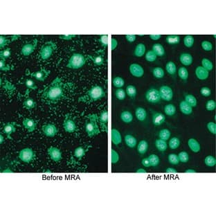 Mycoplasma Removal Agent (MRA) for mycoplasma contamination in cell cultures