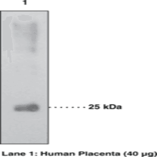 15-hydroxy Prostaglandin Dehydrogenase Polyclonal Antibody avatar