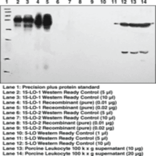 15-Lipoxygenase-1 (rabbit) Polyclonal Antiserum avatar