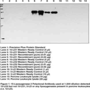 15-Lipoxygenase-2 Polyclonal Antibody avatar