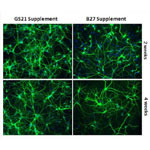 Improving Overall Growth & Performance of Primary Neurons