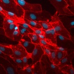 Vericyte%c2%ae_human_dermal_microvascular_endothelial_cells_(hdmecs)