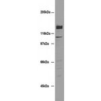 Desmoglein 2 Antibody [7H9] 