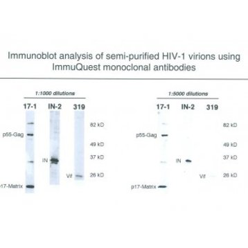 HIV1 p17 Antibody [171]