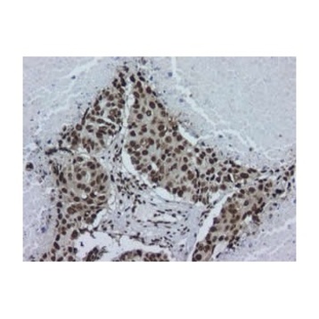 hnRNP A2B1 Antibody [DP3B3] 