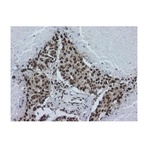 hnRNP A2B1 Antibody [DP3B3] 