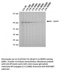 Lamin A+C mutant R453W Antibody [12A-2F5] 