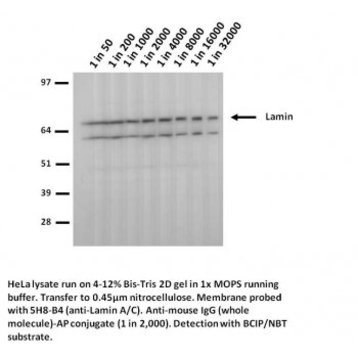 Lamin A+C mutant R482W Antibody [5H8-B4]