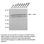 Lamin A+C mutant R482W Antibody [5H8-B4]