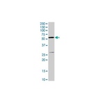 NOX2/gp91phox Antibody [54.1]