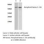 APP/(beta)-Amyloid (1-16) pAb