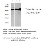 Tubulin (beta) pAb