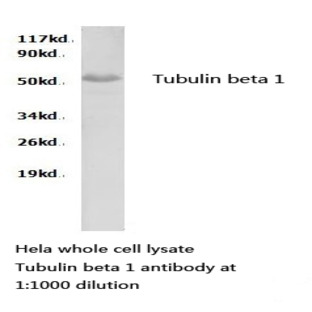 Tubulin beta 1 pAb