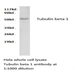 Tubulin beta 1 pAb