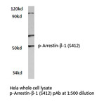 p-Arrestin-(beta)-1 (S412) pAb