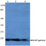 p-MYLPF (S16) pAb