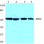ATF2 (K106) pAb