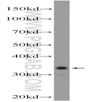 C21orf59 Antibody - chromosome 21 open reading frame 59
