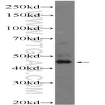 ZDHHC15 Antibody - zinc finger, DHHC-type containing 15