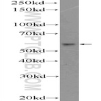 DKC1 Antibody - dyskeratosis congenita 1, dyskerin