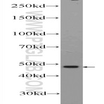 ZNF323 Antibody - zinc finger protein 323