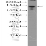 CEBPZ Antibody - CCAAT/enhancer binding protein (C/EBP), zeta