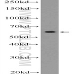 ZBTB22 Antibody - zinc finger and BTB domain containing 22