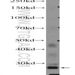 FBXO17 Antibody - F-box protein 17
