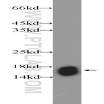 NDUFB5 Antibody - NADH dehydrogenase (ubiquinone) 1 beta subcomplex, 5, 16kDa