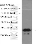 UCP5 Antibody - solute carrier family 25 (mitochondrial carrier, brain), member 14