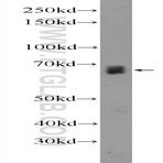ZNF284 Antibody - zinc finger protein 284