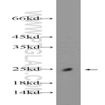 C11orf74 Antibody - chromosome 11 open reading frame 74