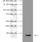 MAGEH1 Antibody - melanoma antigen family H, 1