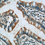 PPYR1 Antibody - pancreatic polypeptide receptor 1