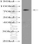 RNF219 Antibody - ring finger protein 219