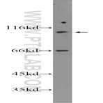 FAM160B1 Antibody - family with sequence similarity 160, member B1