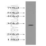 SCN4B Antibody - sodium channel, voltage-gated, type IV, beta