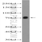 ASIC2 Antibody - amiloride-sensitive cation channel 1, neuronal