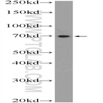 TTC30B Antibody - tetratricopeptide repeat domain 30B