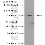 ZNF695 Antibody - zinc finger protein 695