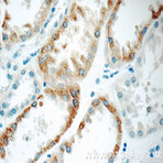 C1QTNF3 Antibody - C1q and tumor necrosis factor related protein 3