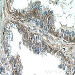 PAGE2 Antibody - P antigen family, member 2 (prostate associated)