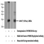 APOBEC3B Antibody - apolipoprotein B mRNA editing enzyme, catalytic polypeptide-like 3B
