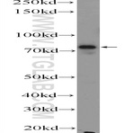Factor XIIIa Antibody - coagulation factor XIII, A1 polypeptide