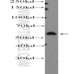 PPM2C Antibody - protein phosphatase 2C, magnesium-dependent, catalytic subunit