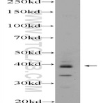 WDR92 Antibody - WD repeat domain 92