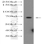 PTPN9 Antibody - protein tyrosine phosphatase, non-receptor type 9