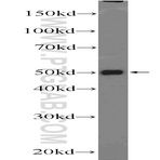 TTC7B Antibody - tetratricopeptide repeat domain 7B