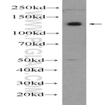 PHF12 Antibody - PHD finger protein 12